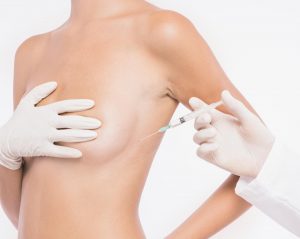 Breast-Augmentation-with-Own-Fat